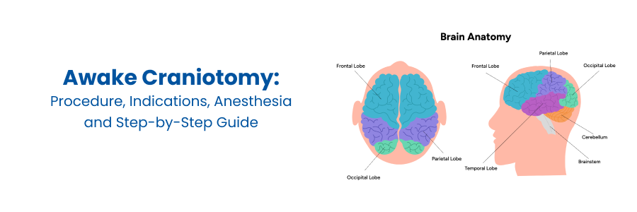 Awake craniotomy procedure, indications, anesthesia and step-by-step guide
