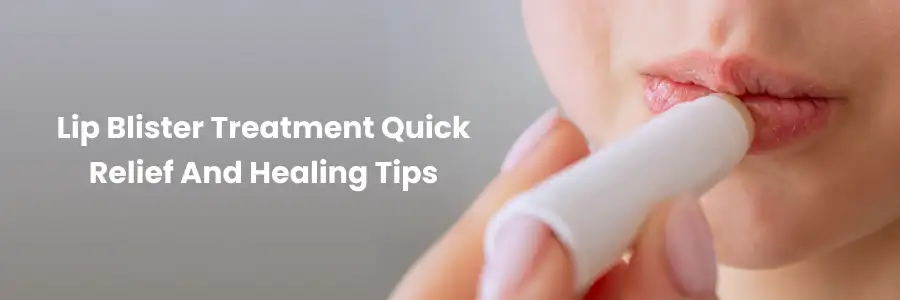 Lip blister treatment quick relief and healing tips